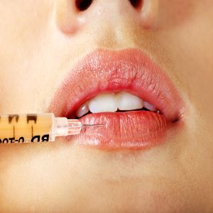 Why a lip augmentation can really make the face