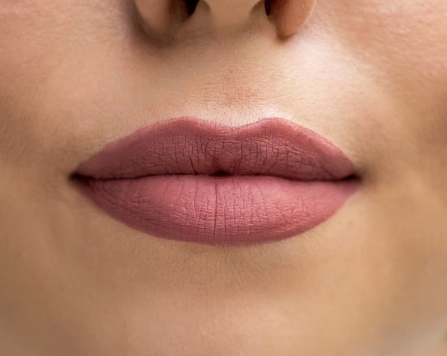 Do Lip Fillers Go Away? Understanding the Longevity of Lip Enhancements